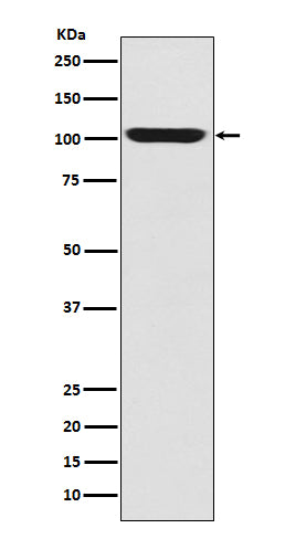 LGR5/GPR49 (2F16) Rabbit Monoclonal Antibody