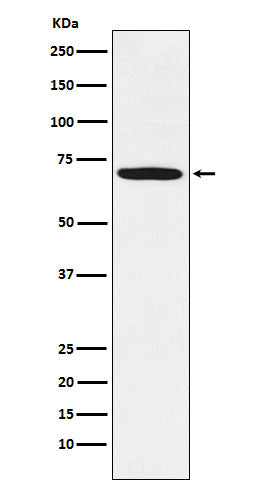LIMK1 (1K5) Rabbit Monoclonal Antibody