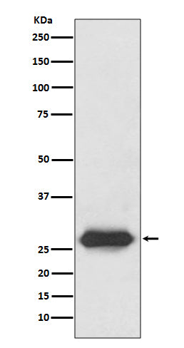 Lin28 (2P18) Rabbit Monoclonal Antibody
