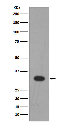 Lin28B (12W5) Rabbit Monoclonal Antibody