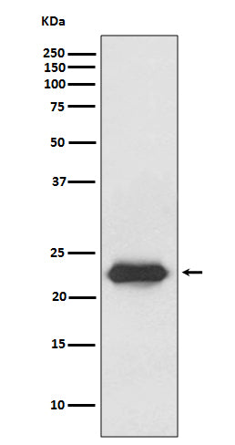 Lipocalin-2 (19M14) Rabbit Monoclonal Antibody