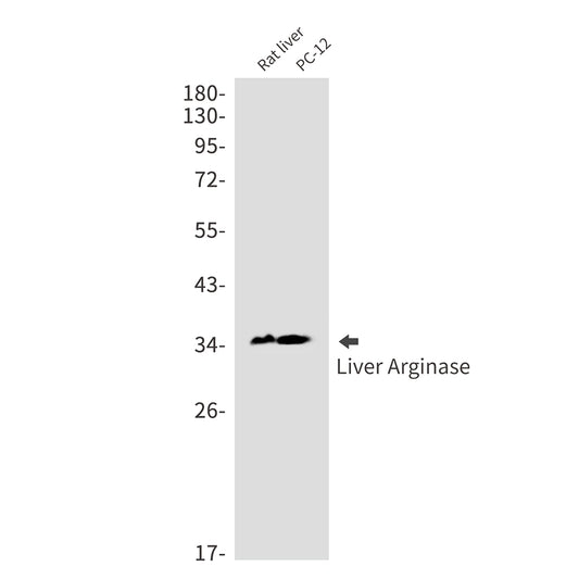 Liver Arginase (11G4) Rabbit Monoclonal Antibody