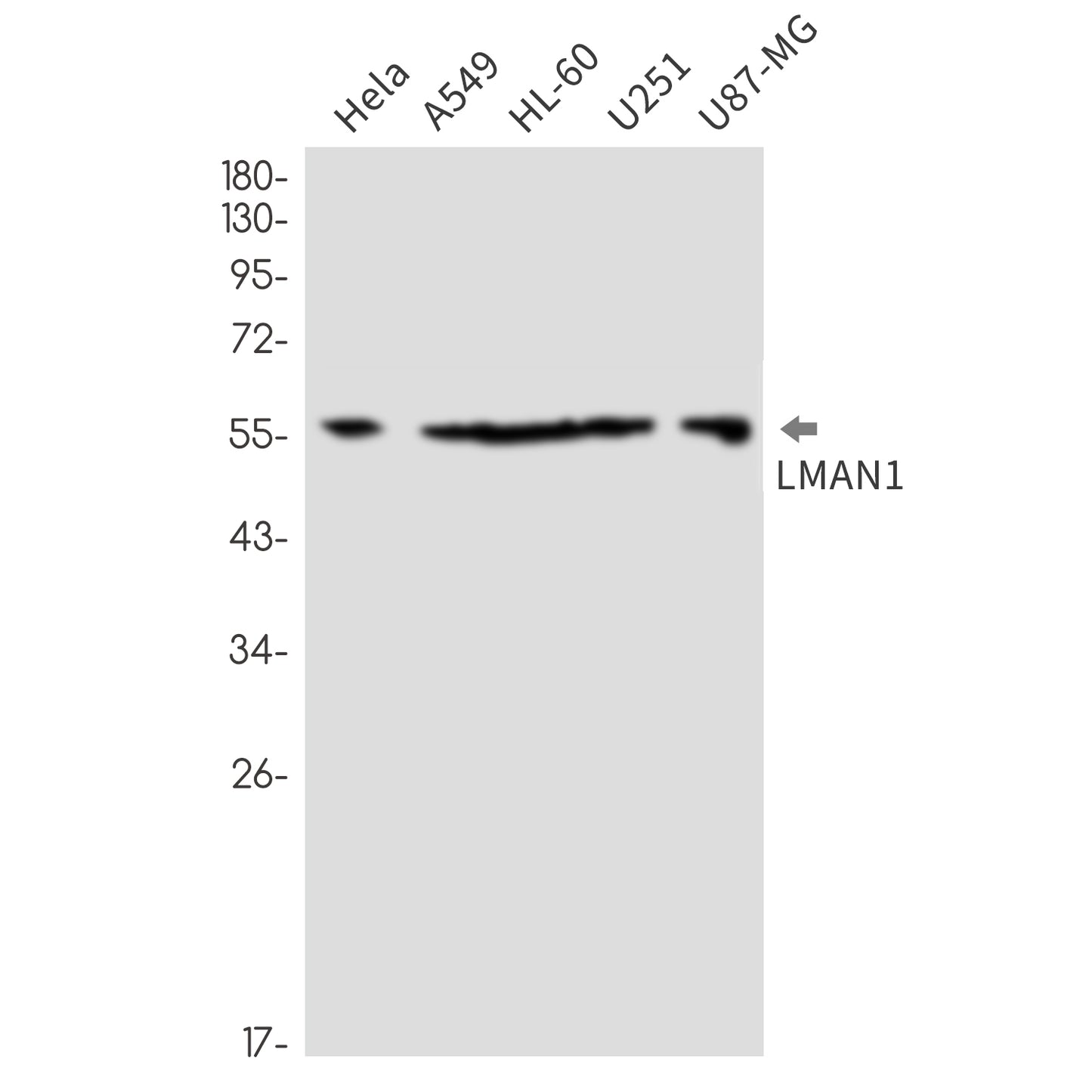 LMAN1 (16Y11) Rabbit Monoclonal Antibody