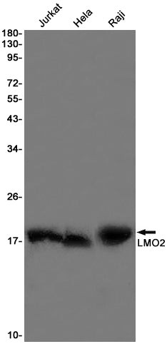LMO2 (5Z19) Rabbit Monoclonal Antibody
