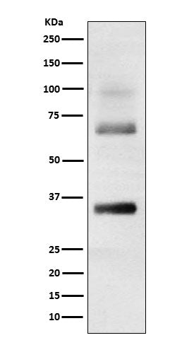 Loricrin (11D11) Rabbit Monoclonal Antibody