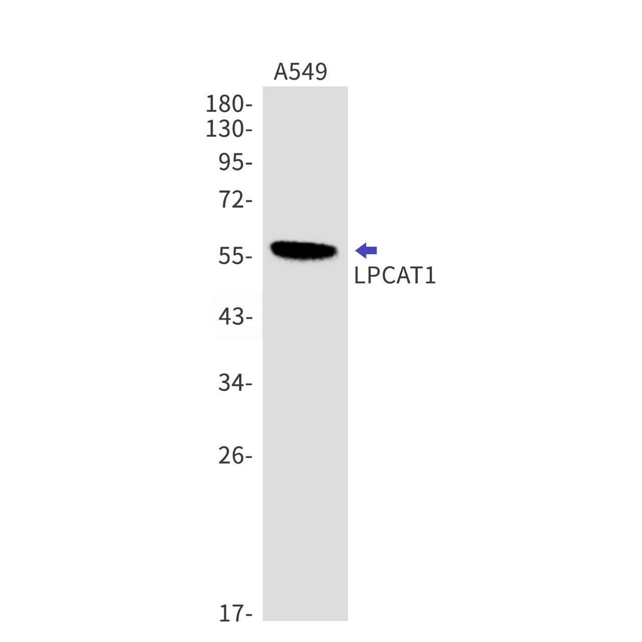 LPCAT1 (13M5) Rabbit Monoclonal Antibody