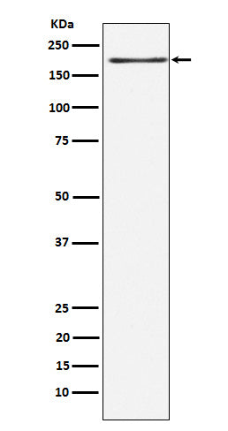 LRP6 (5A10) Rabbit Monoclonal Antibody
