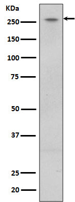 LRRK2  (4E1) Rabbit Monoclonal Antibody