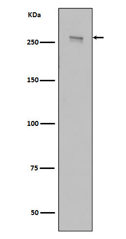 LRRK2 (16M6) Rabbit Monoclonal Antibody