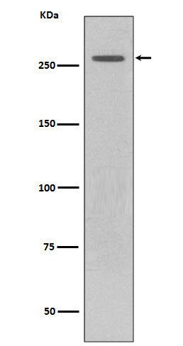 LRRK2 (6P9) Rabbit Monoclonal Antibody