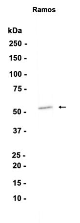 LSP1 (8U19) Rabbit Monoclonal Antibody