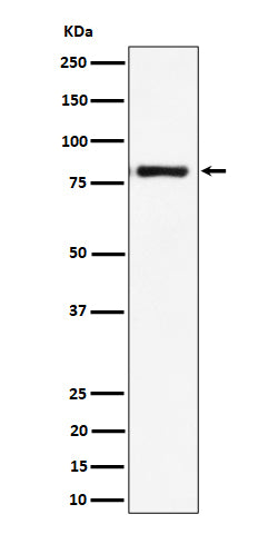 LTK (13P18) Rabbit Monoclonal Antibody