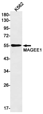 MAGEC2 (3A19) Rabbit Monoclonal Antibody