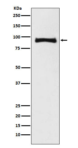 MALT1  (7A3) Rabbit Monoclonal Antibody