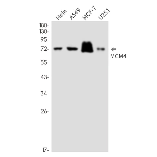 MCM4 (8D13) Rabbit Monoclonal Antibody