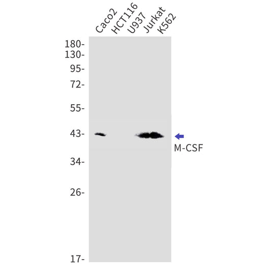 MCSF (11G12) Rabbit Monoclonal Antibody