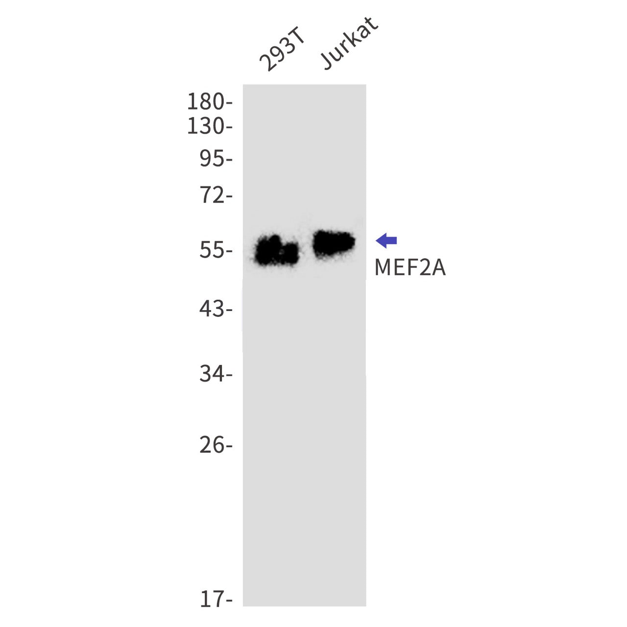 MEF2A (12G4) Rabbit Monoclonal Antibody