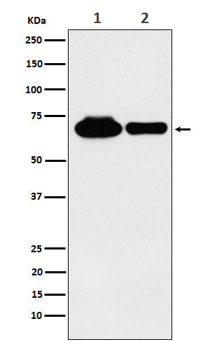 METTL3 (18R12) Rabbit Monoclonal Antibody