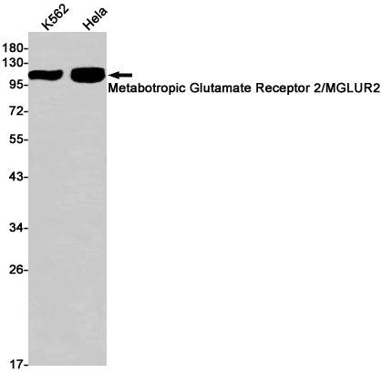 mGluR2 (11P14) Rabbit Monoclonal Antibody