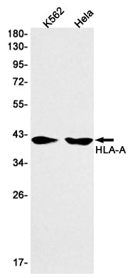 MHC class 1 (7D16) Rabbit Monoclonal Antibody