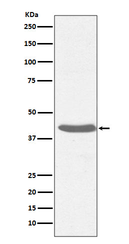 MHC class I (12X3) Rabbit Monoclonal Antibody
