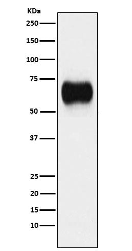 MICA (19R18) Rabbit Monoclonal Antibody