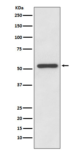 MMP13 (15M12) Rabbit Monoclonal Antibody