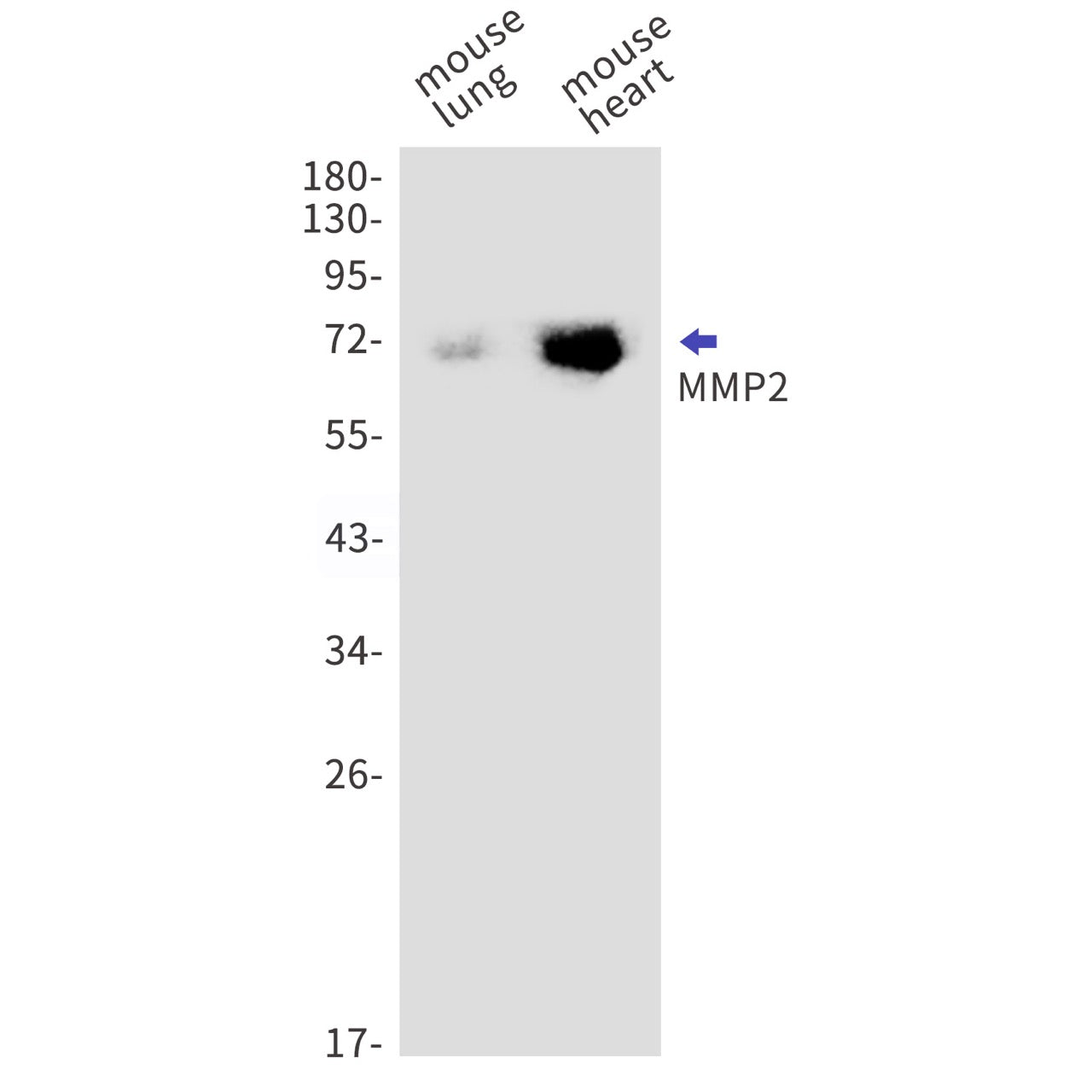 MMP2 (12D11) Rabbit Monoclonal Antibody