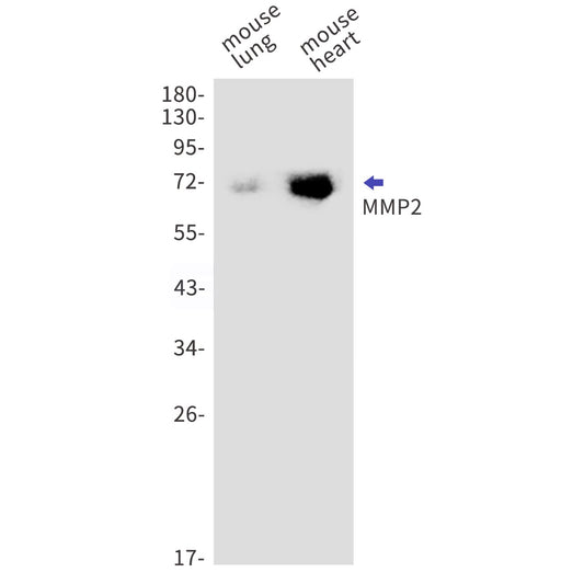MMP2 (12D11) Rabbit Monoclonal Antibody