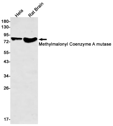 MMUT (11F17) Rabbit Monoclonal Antibody