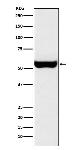 Monoamine Oxidase B (2E2) Rabbit Monoclonal Antibody