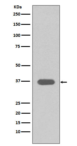 MSI2 (13U1) Rabbit Monoclonal Antibody