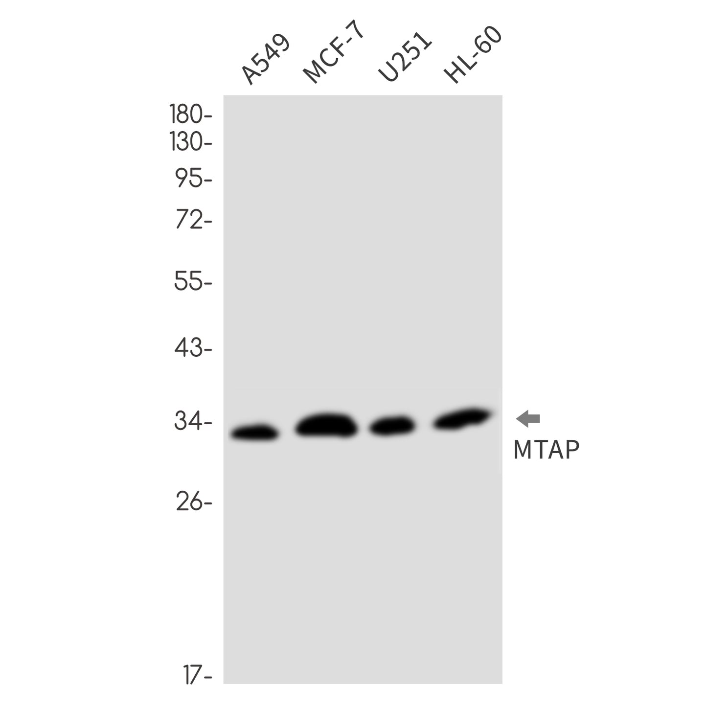 MTAP (17L2) Rabbit Monoclonal Antibody