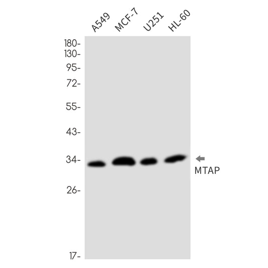 MTAP (17L2) Rabbit Monoclonal Antibody