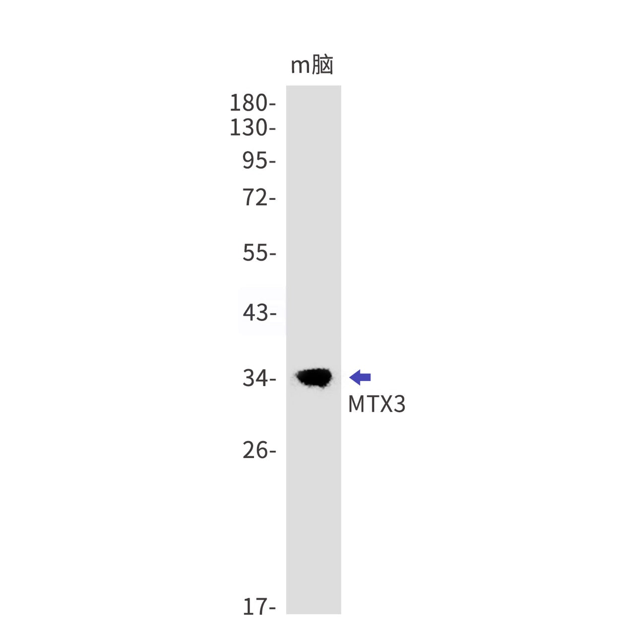 MTX3 (10I6) Rabbit Monoclonal Antibody