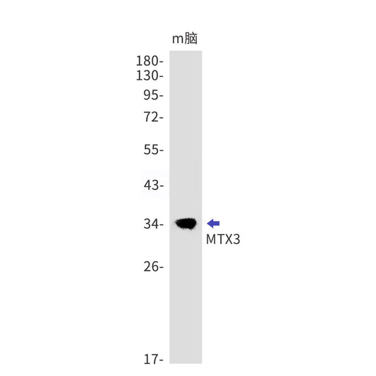MTX3 (10I6) Rabbit Monoclonal Antibody