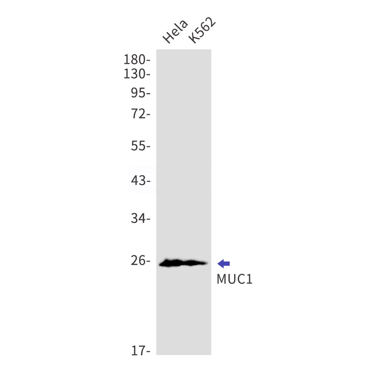 MUC1 (8S2) Rabbit Monoclonal Antibody