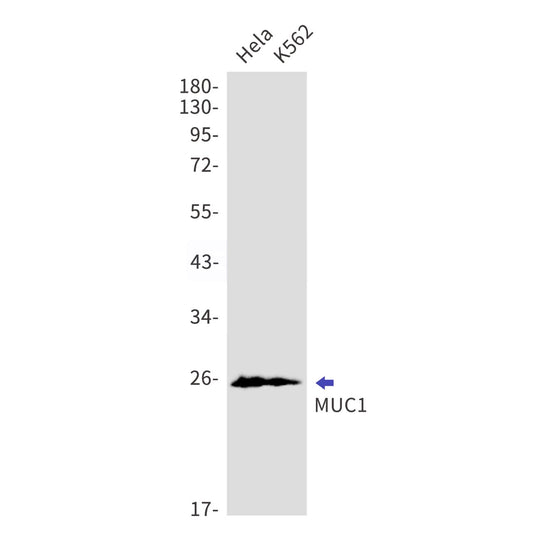 MUC1 (8S2) Rabbit Monoclonal Antibody