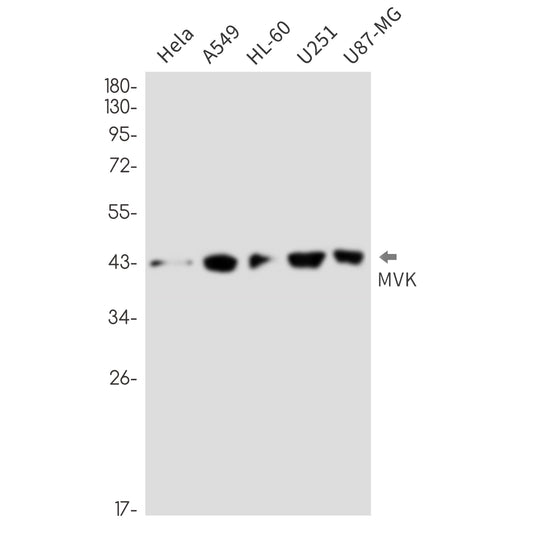 MVK (17J12) Rabbit Monoclonal Antibody