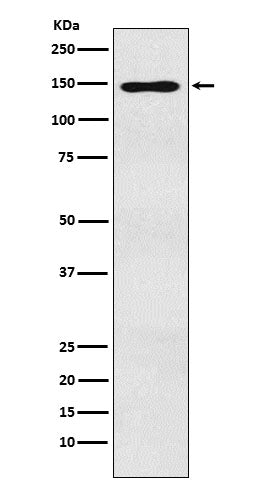 MYBBP1A (14I6) Rabbit Monoclonal Antibody