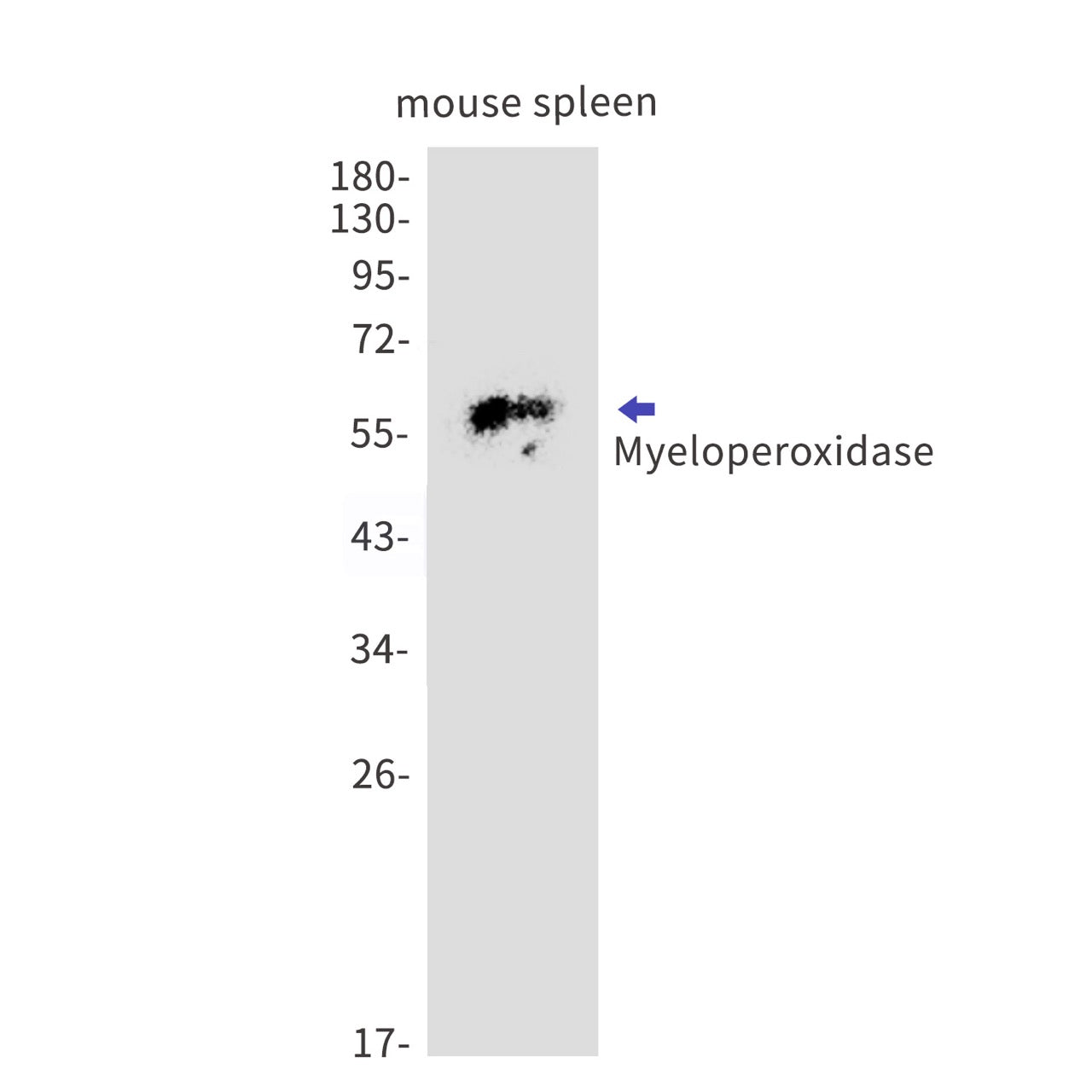 Myeloperoxidase (5D6) Rabbit Monoclonal Antibody