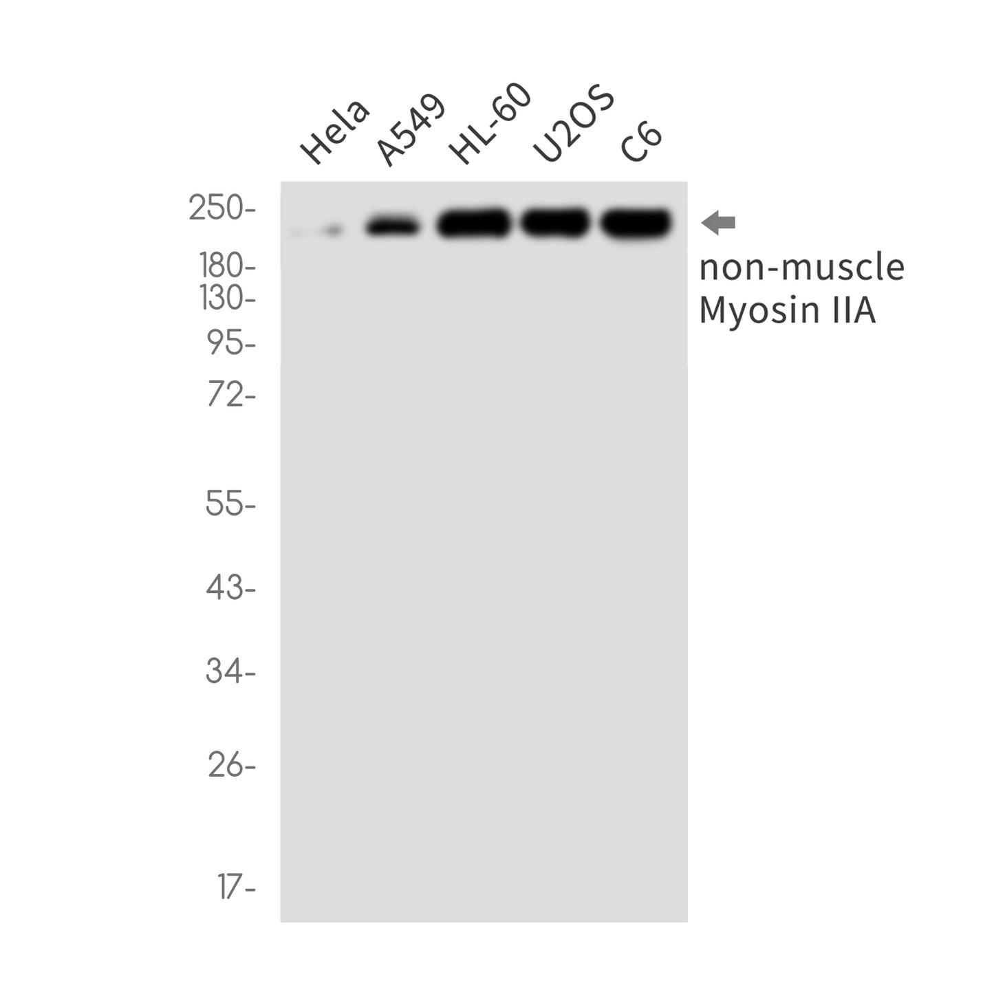 MYH9 (16V8) Rabbit Monoclonal Antibody