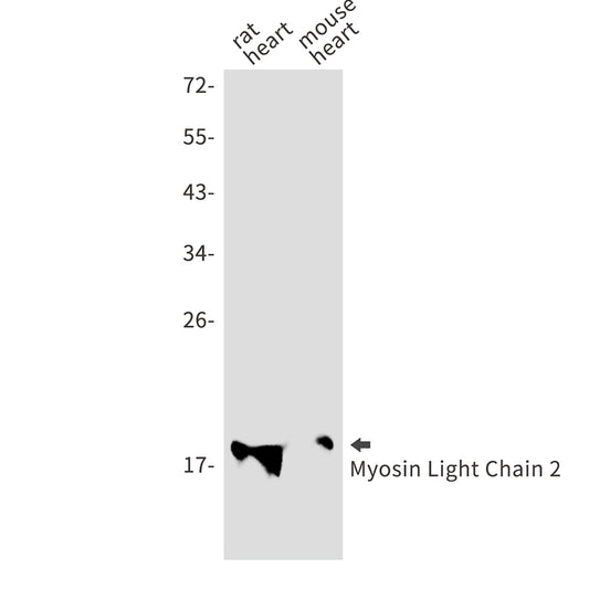 Myosin Light Chain 2 (8D15) Rabbit Monoclonal Antibody