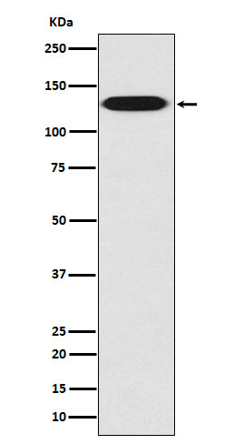 Myosin light chain kinase (19S15) Rabbit Monoclonal Antibody
