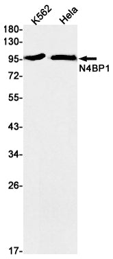 N4BP1 (17R17) Rabbit Monoclonal Antibody