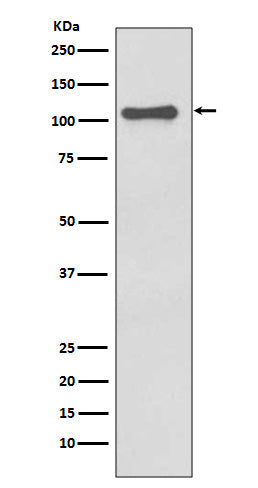 NALP3 (8Q17) Rabbit Monoclonal Antibody