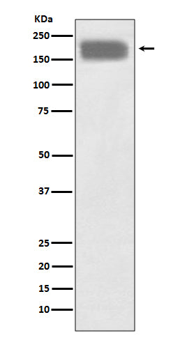 NCAM (6H4) Rabbit Monoclonal Antibody