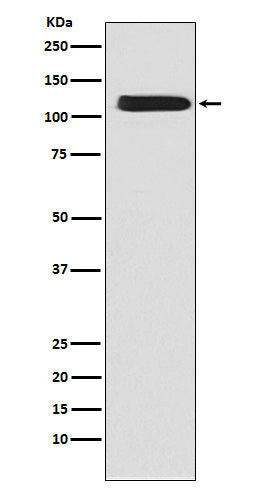 NCX1 (13Y2) Rabbit Monoclonal Antibody