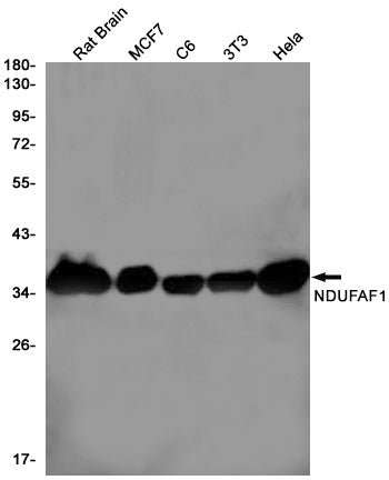 NDUFAF1 (10Z14) Rabbit Monoclonal Antibody