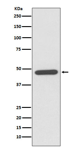 NeuroD1 (11M3) Rabbit Monoclonal Antibody